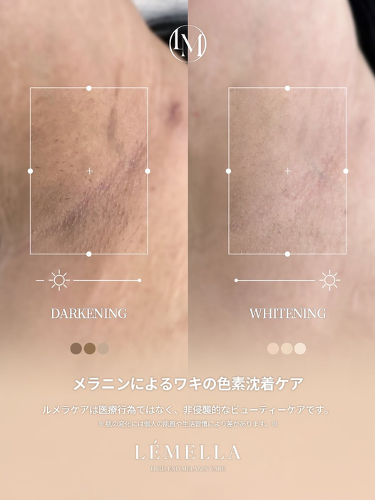 画像527