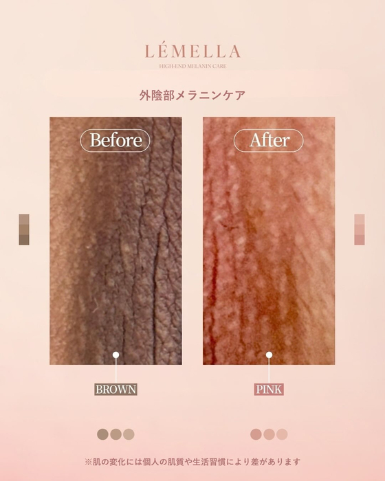 画像556